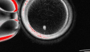 Scientists find way to fertilise eggs made from genetic material of skin cells