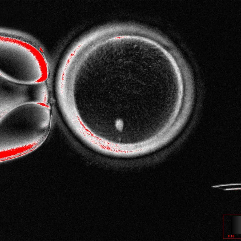 Scientists find way to fertilise eggs made from genetic material of skin cells