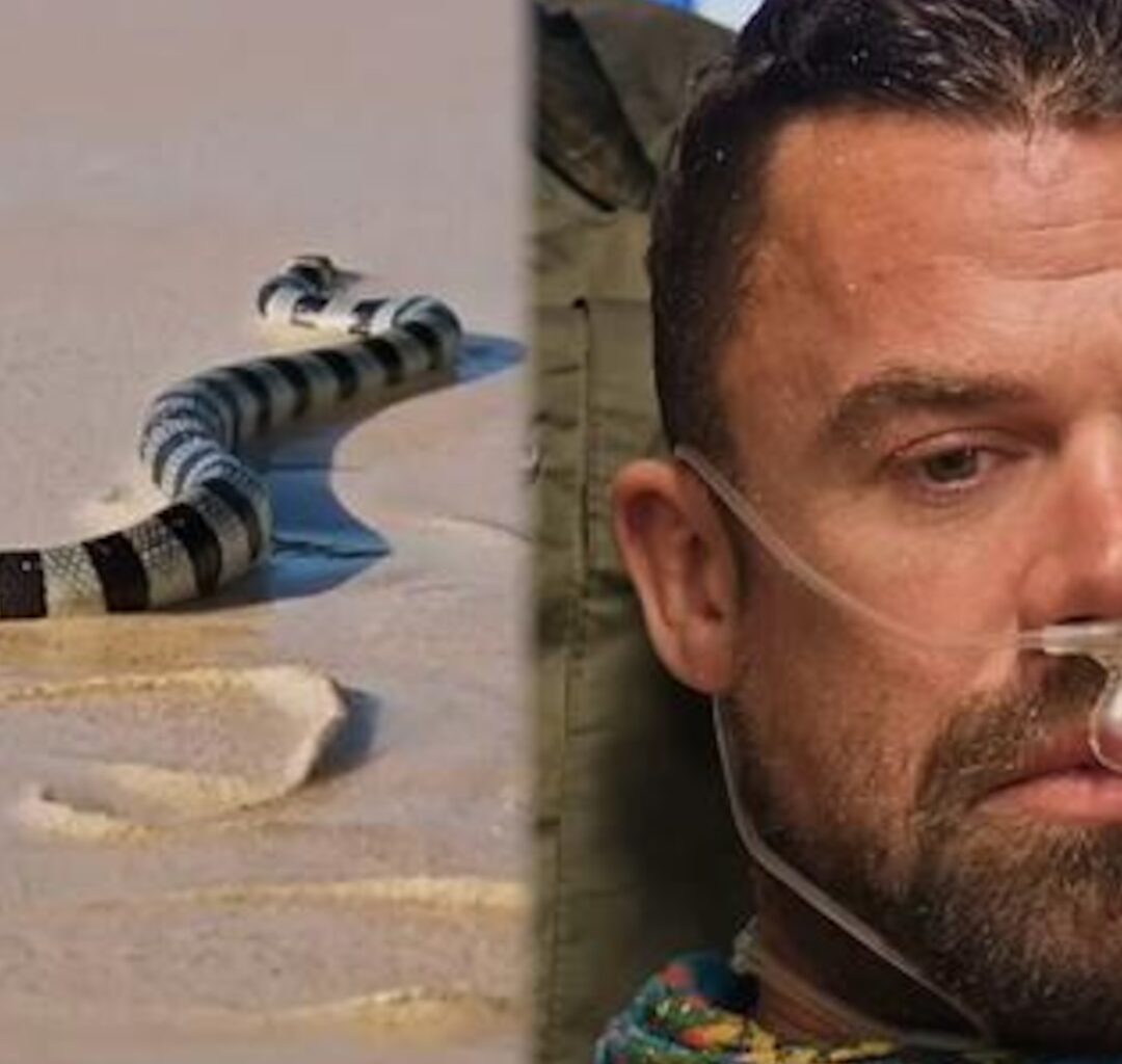 ‘Survivor’ 49’s Jake Latimer Details Recovery After Being Bit by Venomous Snake - E! Online