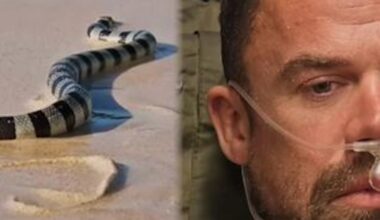 ‘Survivor’ 49’s Jake Latimer Details Recovery After Being Bit by Venomous Snake - E! Online