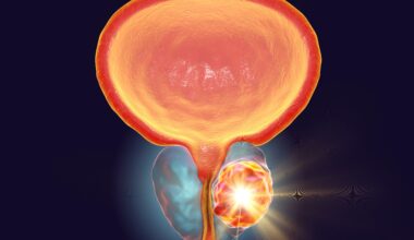 Data from the ROSELLA trial show a consistent benefit with relacorilant plus nab-paclitaxel across PROC subgroups.