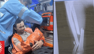 Kiwi's arm 'fully snapped' in Japanese bear attack