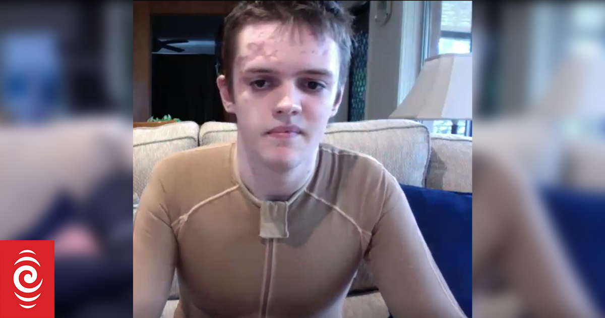 Whakaari eruption survivor recalls extreme pain while being hit by steam, rocks