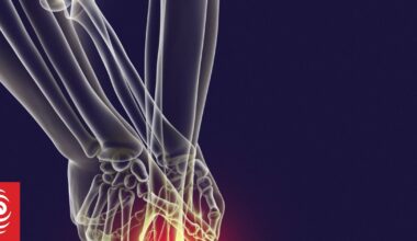 Rheumatology patients suffer significant pain without enough staff - professor