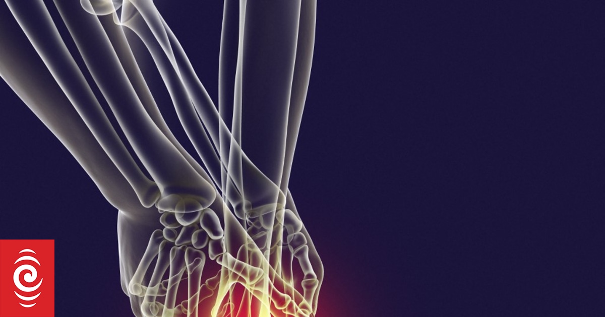 Rheumatology patients suffer significant pain without enough staff - professor