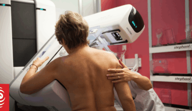 Free breast screening opens up for thousands more women