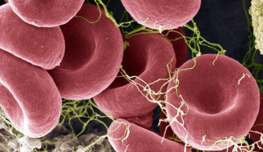 Can a New Blood Test Actually Detect ME/CFS? Here's What We Know : ScienceAlert