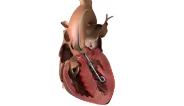 Cybersecurity triggers another recall of J&J’s Impella heart pump controller