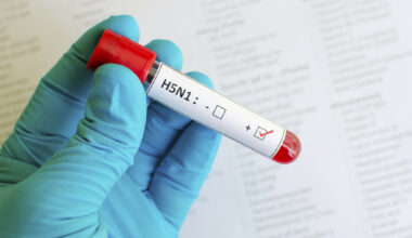 Slovakia reports bird flu outbreak on northern farm
