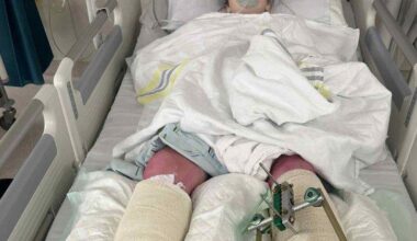 Long road ahead for Oamaru boy badly hurt in skiing fall