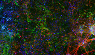 The Worldfolio: Stem Cell Stories: More Than Just Labs
