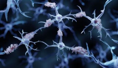 ADAMTS2 Gene Implicated in Alzheimer’s Across Populations