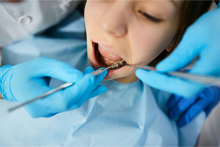 50 Bone-Chilling And Hilarious Stories From People Who Shouldn’t Have Woken Up During Surgery