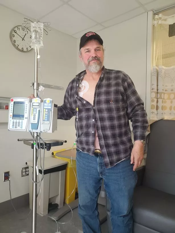 Jim during chemotherapy (Jam Press)