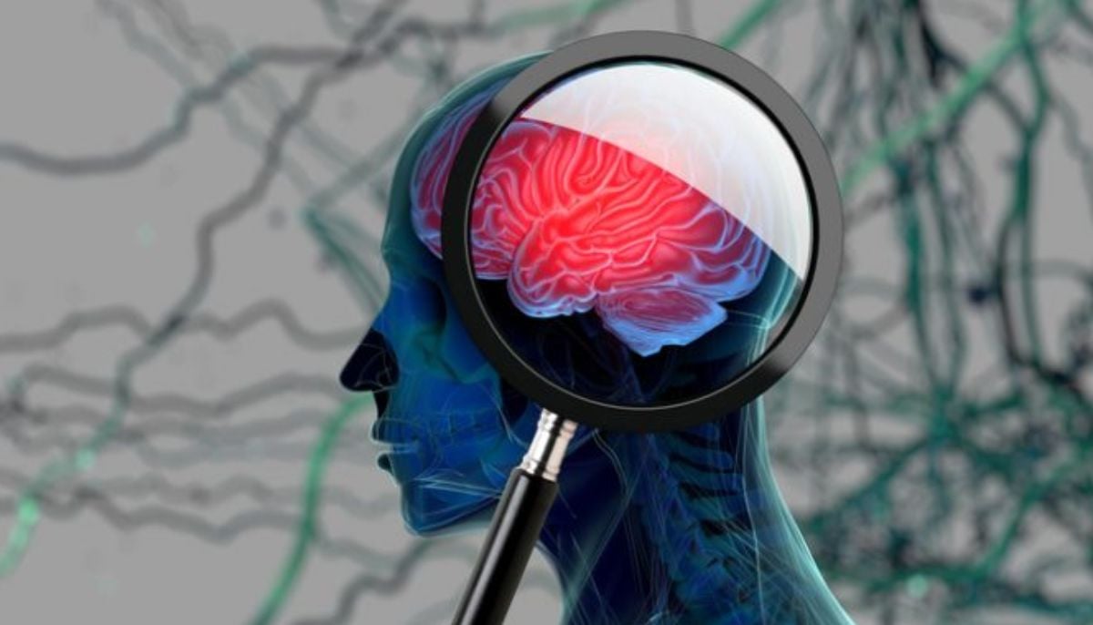 New AI methods can detect dementia with high accuracy
