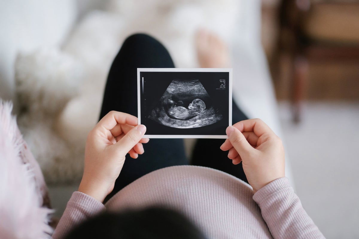 Growing concern over unregulated sonographers and scan clinics after reports of wrongly diagnosing baby loss