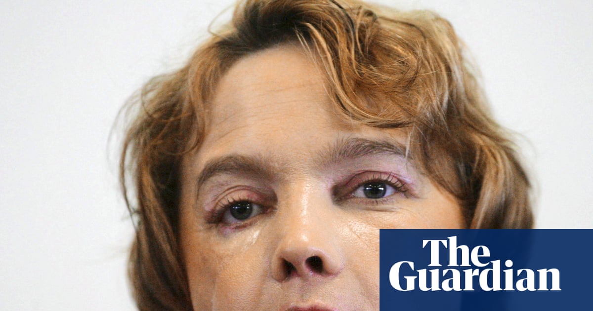 Face transplants promised hope. Patients were put through the unthinkable | Science