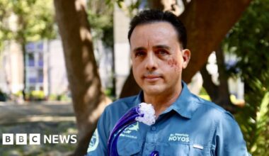 Biologist bitten in head by shark hopes to meet animal again