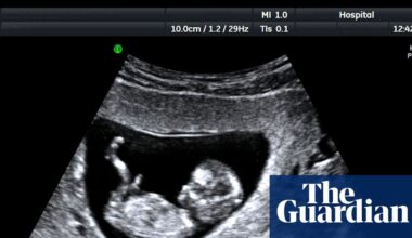 UK’s unregulated pregnancy scan clinics putting lives in danger, say experts | Health