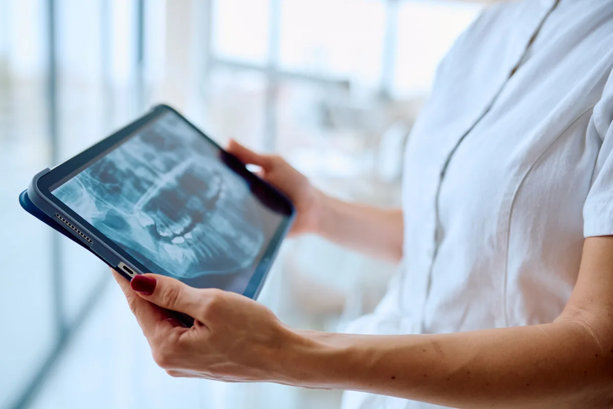 A person holding a tablet device displaying a dental x-ray