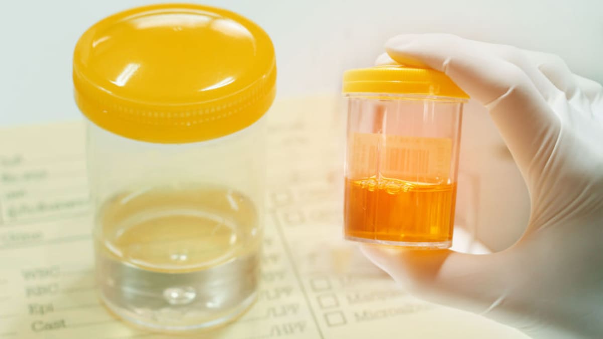Man on parole provides non-human urine sample for compulsory drug tests