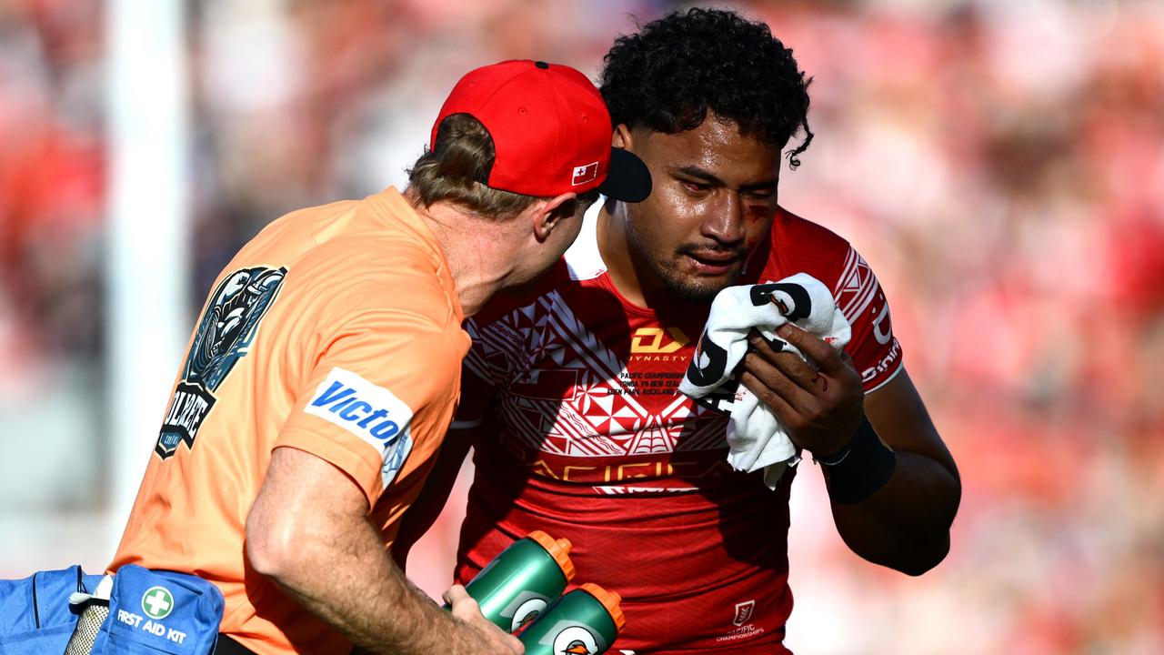 Eliesa Katoa breaks his silence, ruled out for 2026 season, Tonga, Melbourne Storm, Instagram, videos, highlights, news