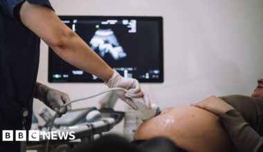 Warning over dangerous high street baby scans