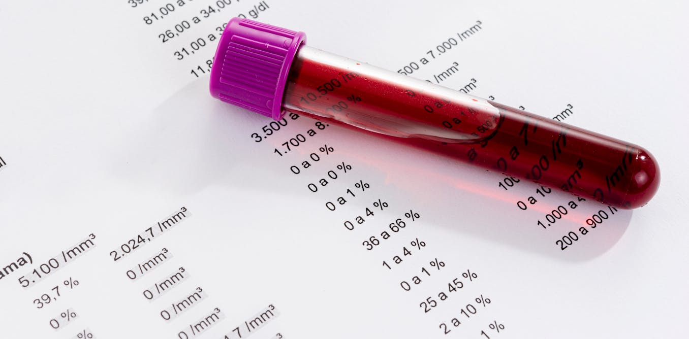 Rethinking blood test reference ranges could make medicine fairer – and safer