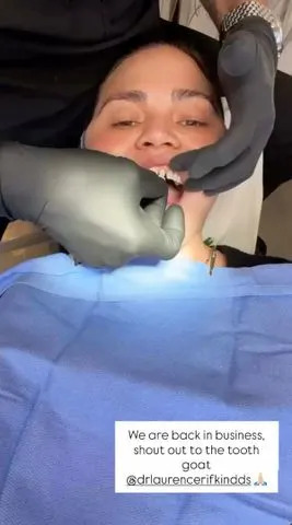 Chrissy Teigen/Instagram Chrissy Teigen has her dental veneer replaced after candy came game mishap