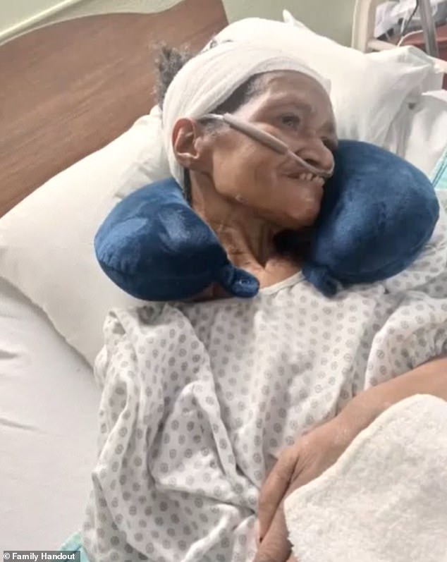 Edna Burton, 61, of Michigan, alleges hospital staff lost a chunk of her skull during surgery and attempted to compensate her with a $25 gas station gift card