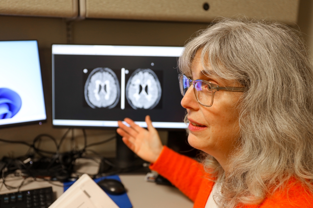 Rebecca Spain, M.D., M.S.P.H., has long curly gray hair, eye glasses and an orange sweater, points to an MRI scan. She is lead author on a new randomized controlled clinical trial testing the over-the-counter supplement lipoic acid in treating progressive forms of multiple sclerosis. (OHSU/Christine Torres Hicks)