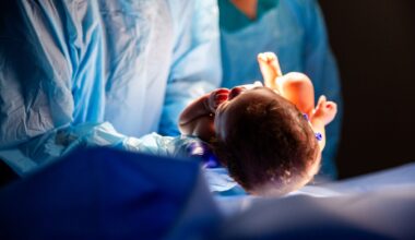 C-sections are now more common than ‘natural’ births