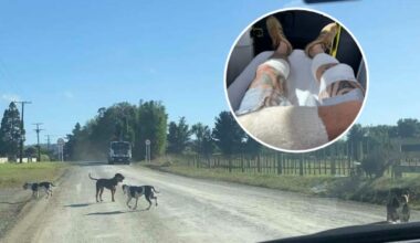 Dog attack victim says Kaipara mauling followed years of complaints