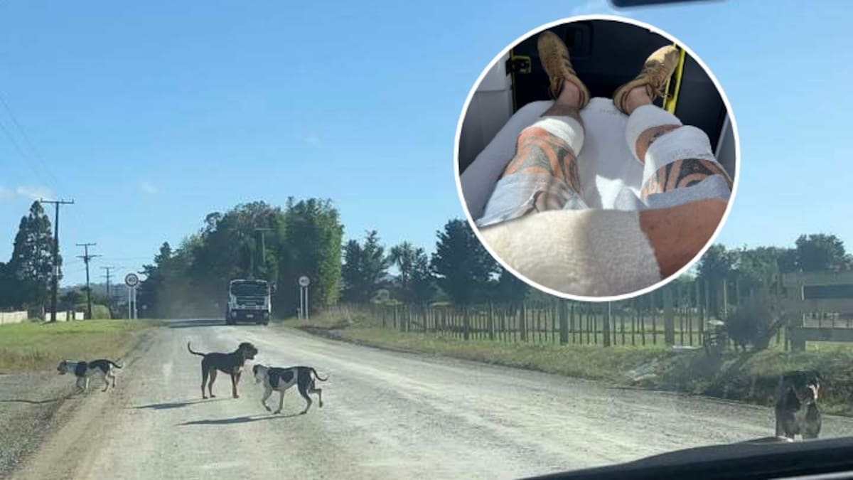 Dog attack victim says Kaipara mauling followed years of complaints