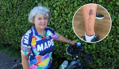 Tauranga woman traumatised after repeat dog attacks while cycling trails