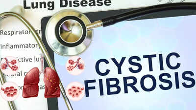 Cystic Fibrosis: Causes, symptoms, diagnosis and modern treatment approaches