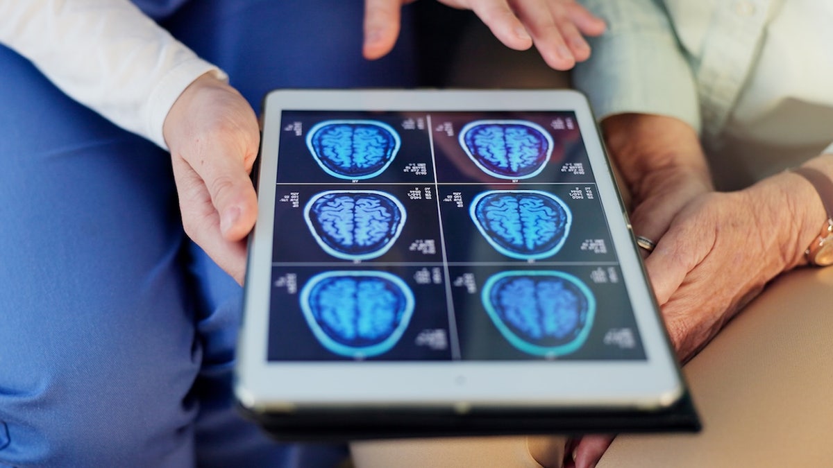 Doctor looking at brain scan images on tablet.