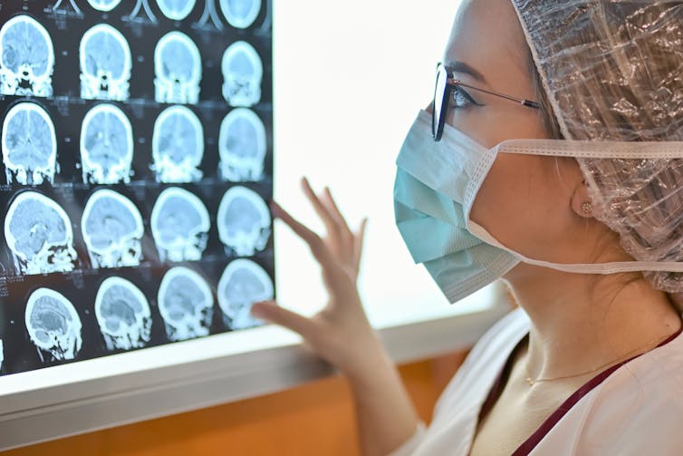 Doctor looking at panel of brain scans.