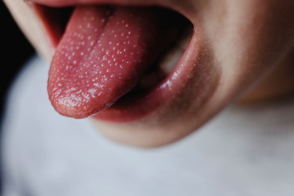 A red tongue could be an indication something is wrong