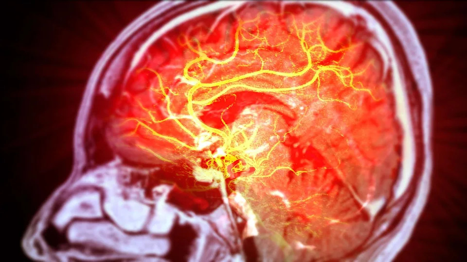 An image shows an X-ray of a human brain