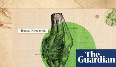 ‘They don’t have a nice socket structure’: how to really look after your knees | Health & wellbeing