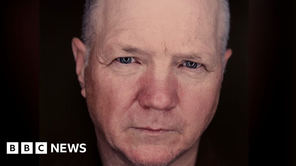 Thousands in NI being offered testing for Celtic curse