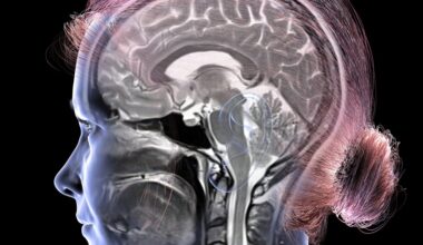 Study Suggests This Amount Of Weekly Exercise Can Keep Your Brain Younger