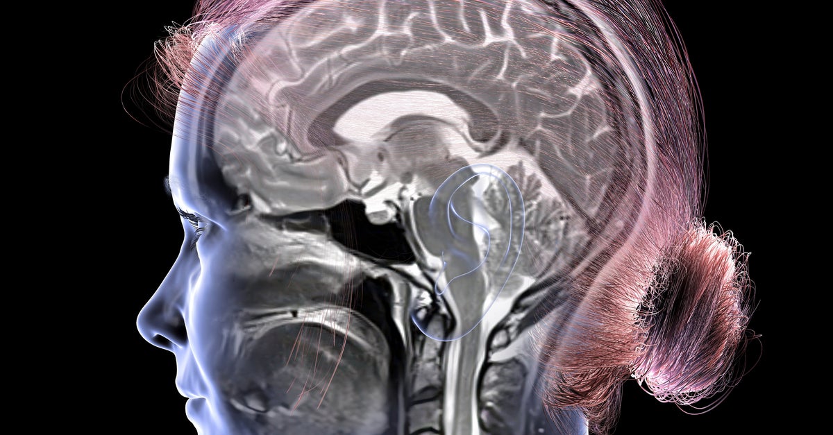 Study Suggests This Amount Of Weekly Exercise Can Keep Your Brain Younger