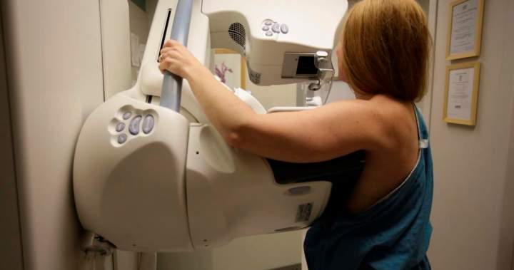 Saskatchewan lowers age eligibility for breast cancer screenings