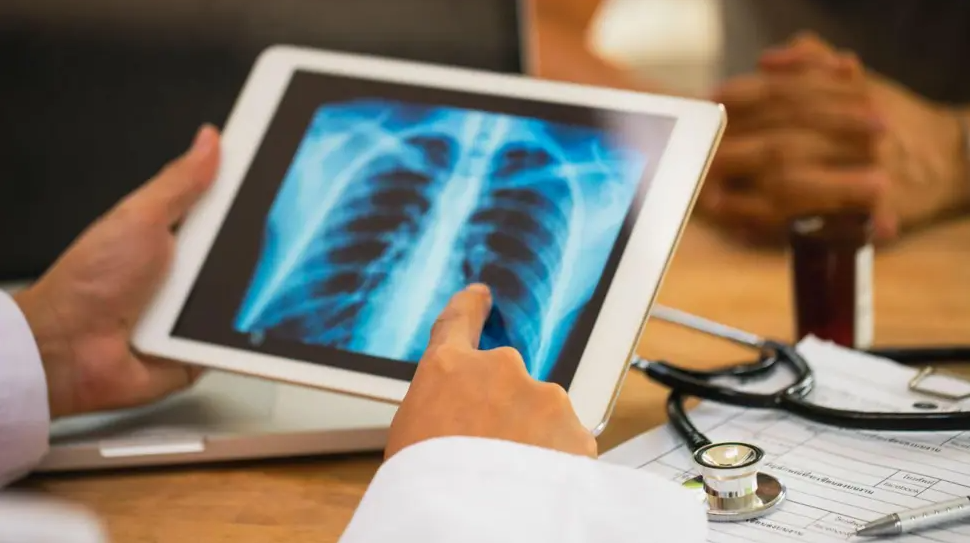 Health bosses act over rising number of TB cases