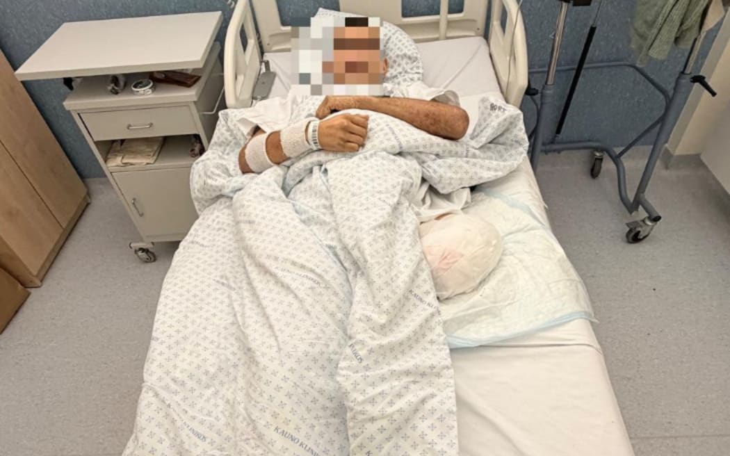 Khol Gillies is recovering in a hospital in Europe after having his leg amputated.