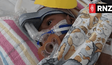 'Thank God': Parents of conjoined twins grateful they defied medical advice