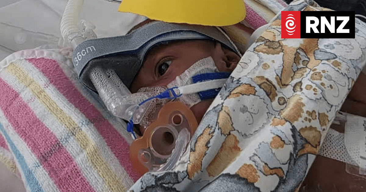 'Thank God': Parents of conjoined twins grateful they defied medical advice