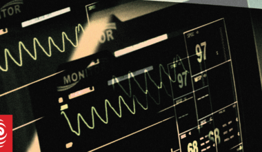 20-year-old man dies after staff miss major red flag his bowel had ruptured